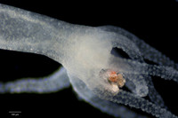 Photomicrography: Darkfield