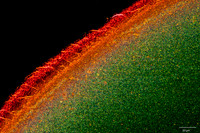 Bacillus, 10x